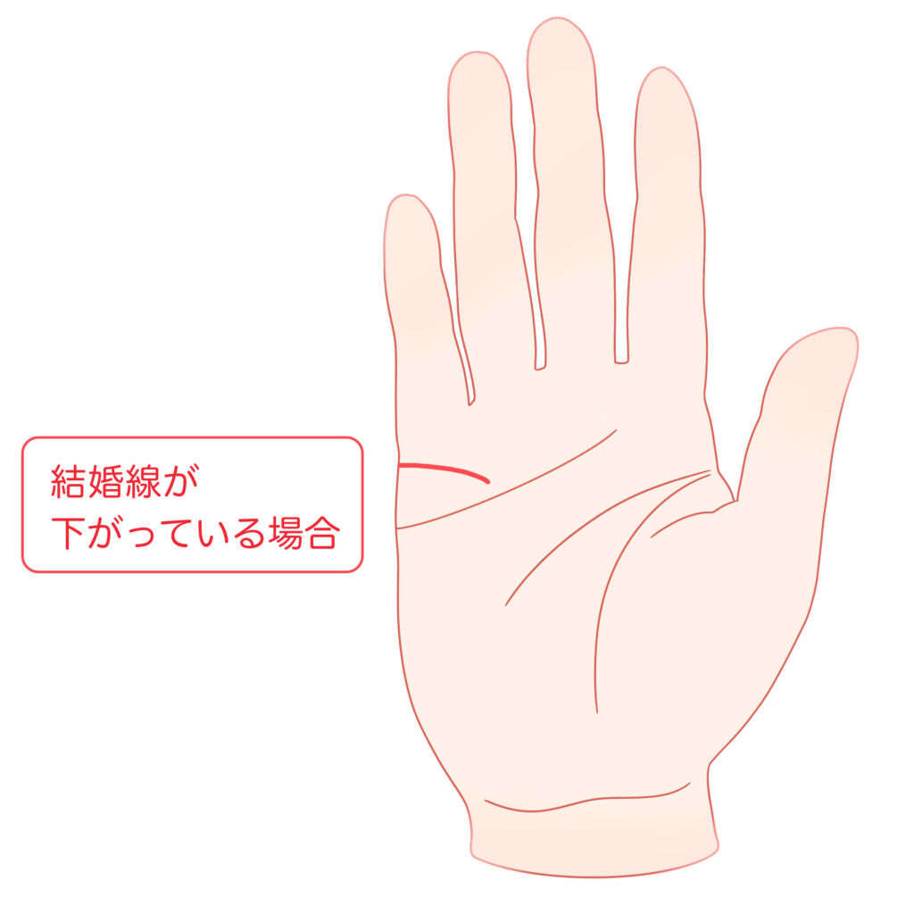 手を詠む: 運命線の切り替わり